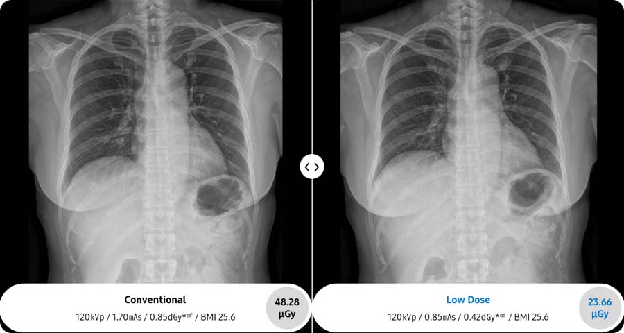 Samsung Healthcare USA | Radiography | GF85